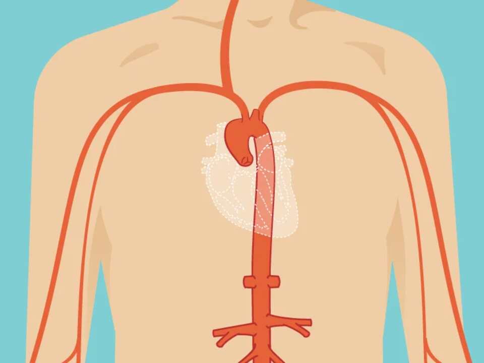 Ascending Aortic Aneurysm Icd 10