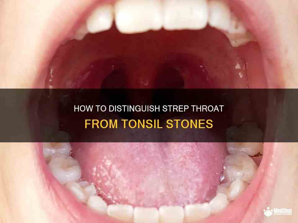 Tonsil Stones Removal Tool