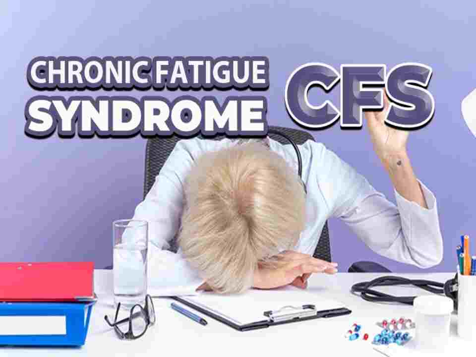 Fatigue Icd 10